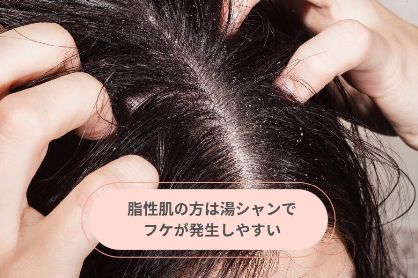 脂性肌はフケが発生しやすい